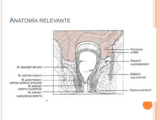 ANATOMÍA RELEVANTE
 