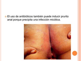   El uso de antibióticos también puede inducir prurito
    anal porque precipita una infección micótica.
 