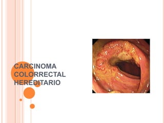 CARCINOMA
COLORRECTAL
HEREDITARIO
 