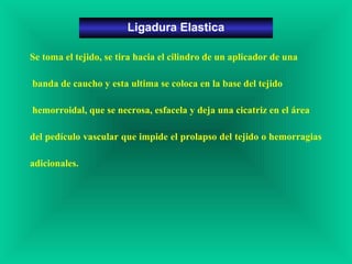 Se toma el tejido, se tira hacia el cilindro de un aplicador de una
banda de caucho y esta ultima se coloca en la base del tejido
hemorroidal, que se necrosa, esfacela y deja una cicatriz en el área
del pedículo vascular que impide el prolapso del tejido o hemorragias
adicionales.
Ligadura Elastica
 
