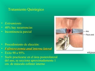 Tratamiento Quirúrgico
• Estiramiento
• 40% hay recurrencias
• Incontinencia parcial
• Procedimiento de elección:
• Esfinterectomía anal interna lateralEsfinterectomía anal interna lateral
• Éxito 90 a 95%
• Suele practicarse en el área posterolateral
del ano, se secciona aproximadamente 1
cm. de músculo esfínter interno
 