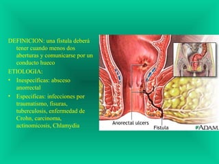 DEFINICION: una fístula deberá
tener cuando menos dos
aberturas y comunicarse por un
conducto hueco
ETIOLOGIA:
• Inespecíficas: absceso
anorrectal
• Especificas: infecciones por
traumatismo, fisuras,
tuberculosis, enfermedad de
Crohn, carcinoma,
actinomicosis, Chlamydia
 