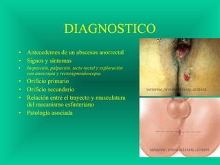 DIAGNOSTICO
• Antecedentes de un abscesos anorrectal
• Signos y síntomas
• Inspección, palpación, tacto rectal y exploración
con anoscopia y rectosigmoidoscopia
• Orificio primario
• Orificio secundario
• Relación entre el trayecto y musculatura
del mecanismo esfinteriano
• Patología asociada
 