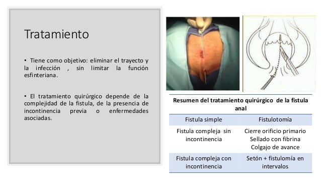 Enfermedades anorrectales