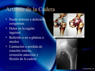 Enfermedades articulares | PPT