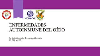 ENFERMEDADES
AUTOINMUNE DEL OÍDO
Dr. Luis Alejandro Torrontegui Zazueta
R1 ORL y CCC
 