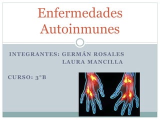 INTEGRANTES: GERMÁN ROSALES
LAURA MANCILLA
CURSO: 3°B
Enfermedades
Autoinmunes
 