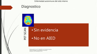 Diagnostico
Enfermedad autoinmune del oído interno
PETSCAN
•Sin evidencia
•No en AIED
Mazlumzadeh M. lowe VJ, Mullan BP, et al. The utility of positron
emission tomography in the evaluation of autoimmune
hearing loss. Otol Neurotol2003;24:201
 