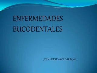 ENFERMEDADES
BUCODENTALES
JEAN PIERRE ARCE CARBAJAL
 
