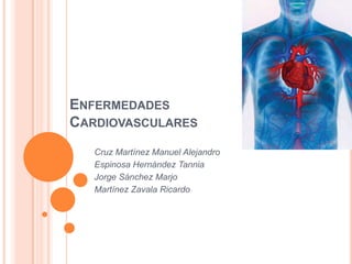 ENFERMEDADES
CARDIOVASCULARES
   Cruz Martínez Manuel Alejandro
   Espinosa Hernández Tannia
   Jorge Sánchez Marjo
   Martínez Zavala Ricardo
 