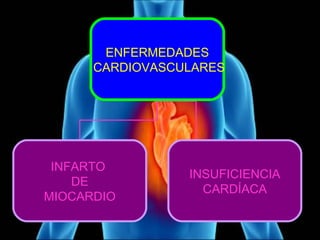ENFERMEDADES 
CARDIOVASCULARES 
INFARTO 
DE 
MIOCARDIO 
INSUFICIENCIA 
CARDÍACA 
 