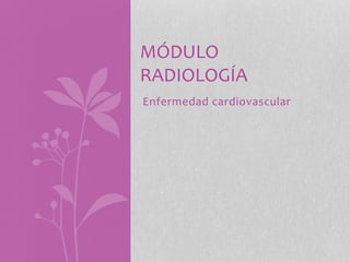 Enfermedad cardiovascular
MÓDULO
RADIOLOGÍA
 
