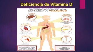 Deficiencia de Vitamina D
 