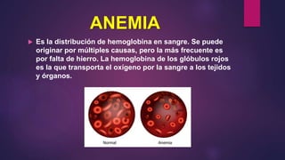 ANEMIA
 Es la distribución de hemoglobina en sangre. Se puede
originar por múltiples causas, pero la más frecuente es
por falta de hierro. La hemoglobina de los glóbulos rojos
es la que transporta el oxígeno por la sangre a los tejidos
y órganos.
 