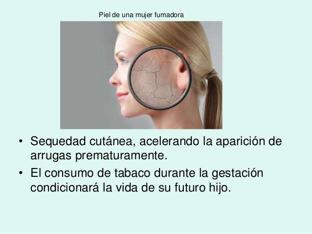 Como dejar fumar es ahora y
