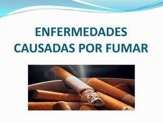 ENFERMEDADES
CAUSADAS POR FUMAR
 