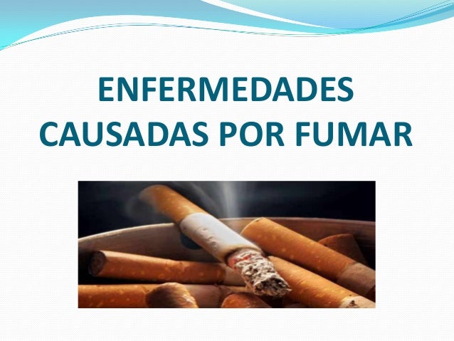 Kirov la codificación del fumar