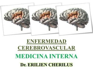 Dr. ERILIEN CHERILUS
ENFERMEDAD
CEREBROVASCULAR.
MEDICINA INTERNA
 