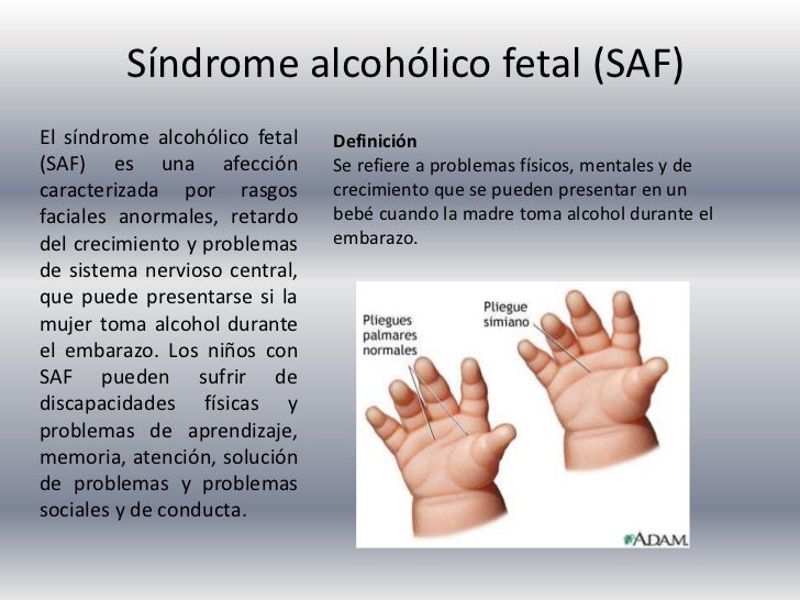 Los preparados al tratamiento contra el alcoholismo
