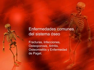 Enfermedades comunes
del sistema óseo
Fracturas, Infecciones,
Osteoporosis, Artritis,
Osteomielitis y Enfermedad
de Paget.
 