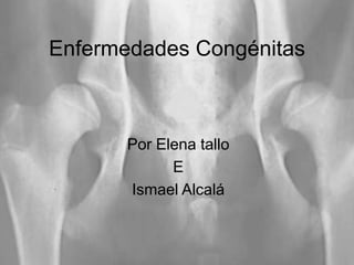 Enfermedades Congénitas Por Elena tallo  E Ismael Alcalá 