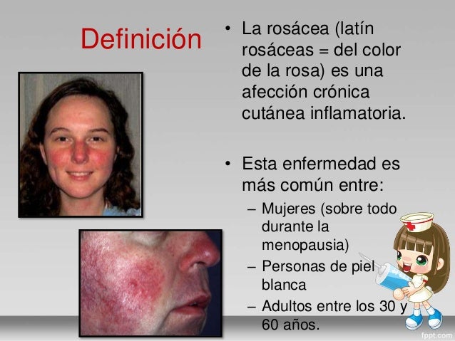 Curar atopichesky la dermatitis a los niños sobre la persona
