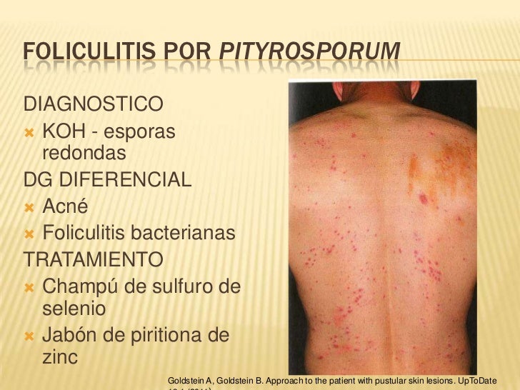 Enfermedades cutáneas producidas por hongos1.pps Enfermedades cutáneas producidas por hongos1.pps
