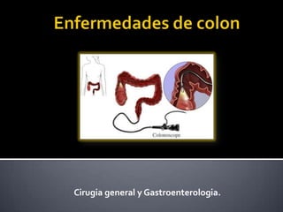 Cirugia general y Gastroenterologia.
 
