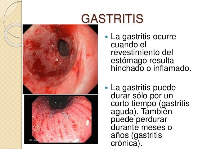 Como adelgazar después de que ha dejado a fumar