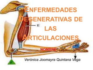 Enfermedades Degenerativas de las Articulaciones NOMBRE : VerònicaJoomayra Quintana Vega 