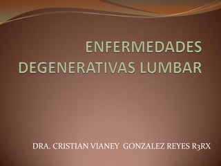 ENFERMEDADES DEGENERATIVAS LUMBAR DRA. CRISTIAN VIANEY  GONZALEZ REYES R3RX 