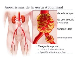Aneurismas de la Aorta Abdominal
 Más frecuente en hombres que
en mujeres
 Incidencia aumenta con la edad
 1-2% de hombres > 50 años
 90% de los aneurismas > 4cm
relacionados con
ateroesclerosis
 La mayoría debajo de origen de
arterias renales
 Riesgo de ruptura:
 1-2% a 5 años si < 5cm
 20-40% a 5 años si > 5cm
 