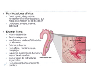  Manifestaciones clínicas:
 Dolor agudo, desgarrante,
frecuentemente interescapular, que
migra en dirección de la disección
 Diaforesis, sínope, disnea,
debilidad
 Examen físico:
 Hiper/hipotensión
 Pérdida de pulsos
 Insuficiencia aórtica (50% de las
proximales)
 Edema pulmonar
 Hemiplejía, hemianestesia,
paraplejia
 Isquemia mesentérica, hematuria,
isquemia miocárdica
 Compresión de estructuras
adyacentes
 Hemopericardio/taponamiento
cardiaco
 