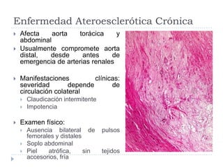 Enfermedad Ateroesclerótica Crónica
 Afecta aorta torácica y
abdominal
 Usualmente compromete aorta
distal, desde antes de
emergencia de arterias renales
 Manifestaciones clínicas:
severidad depende de
circulación colateral
 Claudicación intermitente
 Impotencia
 Examen físico:
 Ausencia bilateral de pulsos
femorales y distales
 Soplo abdominal
 Piel atrófica, sin tejidos
accesorios, fría
 