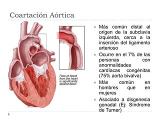 Coartación Aórtica
 Más común distal al
origen de la subclavia
izquierda, cerca a la
inserción del ligamento
arterioso
 Ocurre en el 7% de las
personas con
anormalidades
cardíacas congénitas
(75% aorta bivalva)
 Más común en
hombres que en
mujeres
 Asociado a disgenesia
gonadal (Ej: Síndrome
de Turner)
 