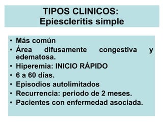 TIPOS CLINICOS:  Epiescleritis simple <ul><li>Más común </li></ul><ul><li>Área difusamente congestiva y edematosa. </li></...