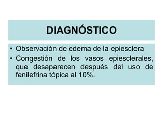 DIAGNÓSTICO <ul><li>Observación de edema de la epiesclera </li></ul><ul><li>Congestión de los vasos epiesclerales, que des...