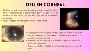 Enfermedades de la Córnea, Oftalmología. | PDF