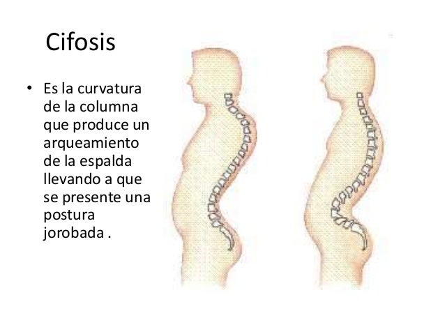 Tira la parte inferior del vientre y duele los riñones en 8 semana del embarazo