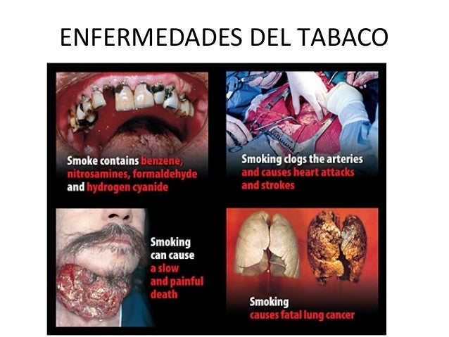El coste de la codificación del alcoholismo en spb