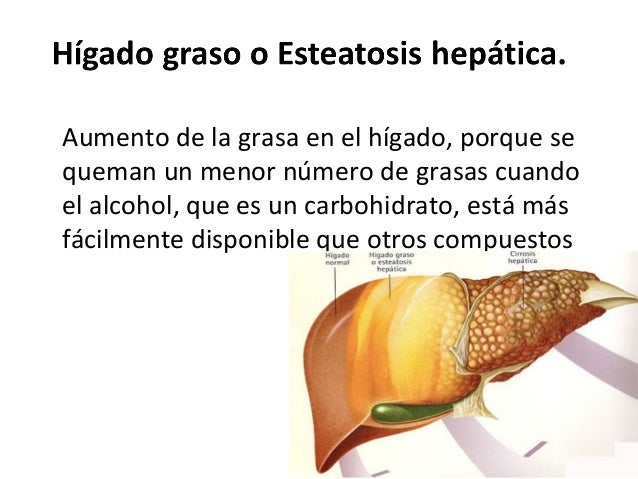 Adelgazar 10 kilos en una semana sin ejercicio Limn adelgazar 10 kilos en una semana sin ejercicio