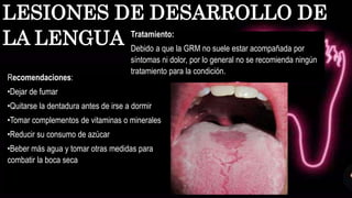 Recomendaciones:
•Dejar de fumar
•Quitarse la dentadura antes de irse a dormir
•Tomar complementos de vitaminas o minerales
•Reducir su consumo de azúcar
•Beber más agua y tomar otras medidas para
combatir la boca seca
LESIONES DE DESARROLLO DE
LA LENGUA Tratamiento:
Debido a que la GRM no suele estar acompañada por
síntomas ni dolor, por lo general no se recomienda ningún
tratamiento para la condición.
 