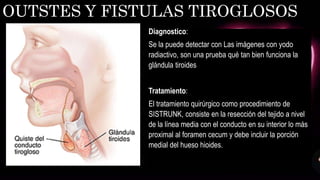 Diagnostico:
Se la puede detectar con Las imágenes con yodo
radiactivo, son una prueba qué tan bien funciona la
glándula tiroides
Tratamiento:
El tratamiento quirúrgico como procedimiento de
SISTRUNK, consiste en la resección del tejido a nivel
de la línea media con el conducto en su interior lo más
proximal al foramen cecum y debe incluir la porción
medial del hueso hioides.
OUTSTES Y FISTULAS TIROGLOSOS
 