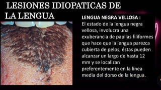 LESIONES IDIOPATICAS DE
LA LENGUA LENGUA NEGRA VELLOSA :
El estado de la lengua negra
vellosa, involucra una
exuberancia de papilas filiformes
que hace que la lengua parezca
cubierta de pelos, éstas pueden
alcanzar un largo de hasta 12
mm y se localizan
preferentemente en la línea
media del dorso de la lengua.
 