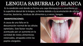 MANIFESTACIONES:
A causa de una falla en la
descamación normal de las células
epiteliales. Este factor resulta
acentuado por un aumento en la
cantidad de restos alimenticios
estancados, atrapados entre las
papilas alargadas.
LENGUA SABURRAL O BLANCA
Es la condición oral donde se forma una capa blanquecina o amarillenta en
la superficie dorsal de la lengua, se forma debido a la acumulación de células
muertas, bacterias, residuos de alimentos y, a veces, hongos.
 