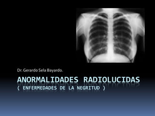 ANORMALIDADES RADIOLUCIDAS
( ENFERMEDADES DE LA NEGRITUD )
Dr.Gerardo Sela Bayardo.
 
