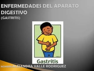 ENFERMEDADES DEL APARATO DIGESTIVO (GASTRITIS)NOMBRE:ALEJANDRA VALLE RODRIGUEZ 