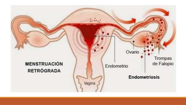 10 Enfermedades Del Sistema Reproductor Femenino www.slideshare.net