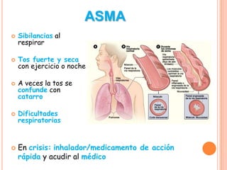 Enfermedades Del Aparato Respiratorio PPTX enfermedades-del-aparato-respiratorio-pptx