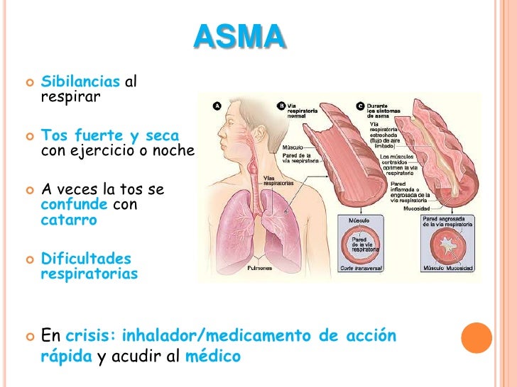 Enfermedades del aparato respiratorio
